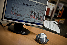 Das Foto zeigt das Diagnostik-Armband SenseWear der Firma BodyMedia in der Praxis Liebermann